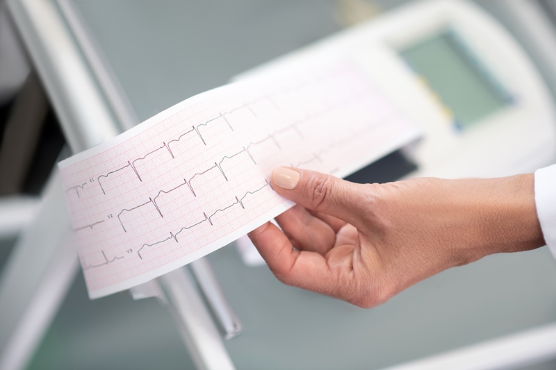 Specialisti elettrocardiogramma Palermo